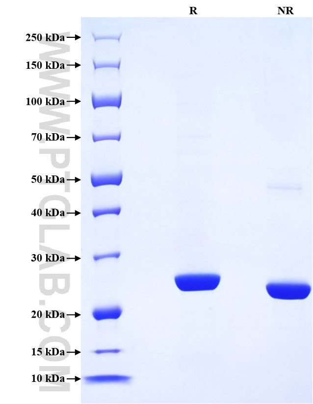 Purity of Recombinant Human Complement factor D was determined by SDS-PAGE. The protein was resolved in an SDS-PAGE in reducing (R) and non-reducing (NR) conditions and stained using Coomassie blue.