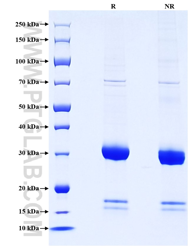 Purity of Recombinant Mouse IGFBP2 was determined by SDS-PAGE. The protein was resolved in an SDS-PAGE in reducing (R) and non-reducing (NR) conditions and stained using Coomassie blue.