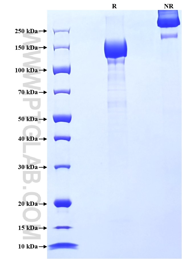 Purity of Recombinant Human Alpha-2-Macroglobulin was determined by SDS-PAGE. The protein was resolved in an SDS-PAGE in reducing (R) and non-reducing (NR) conditions and stained using Coomassie blue.