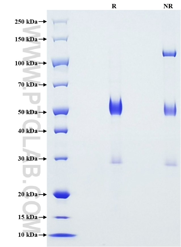 Purity of Recombinant Human HSP47 was determined by SDS-PAGE. The protein was resolved in an SDS-PAGE in reducing (R) and non-reducing (NR) conditions and stained using Coomassie blue.