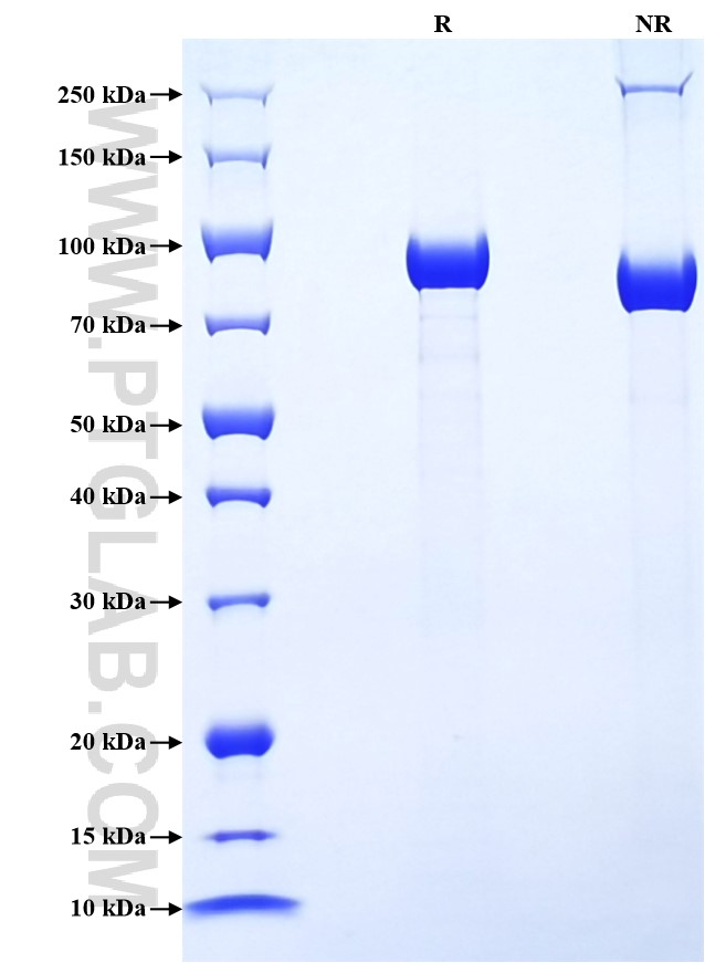 Purity of Recombinant Human Complement factor B was determined by SDS-PAGE. The protein was resolved in an SDS-PAGE in reducing (R) and non-reducing (NR) conditions and stained using Coomassie blue.