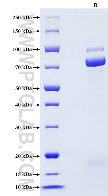 Purity of Recombinant Rat E-Cadherin was determined by SDS-PAGE. The protein was resolved in an SDS-PAGE in reducing (R) conditions and stained using Coomassie blue.