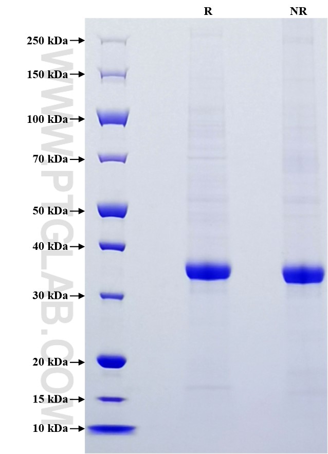 Purity of Recombinant Mouse Galectin-3 was determined by SDS-PAGE. The protein was resolved in an SDS-PAGE in reducing (R) and non-reducing (NR) conditions and stained using Coomassie blue.