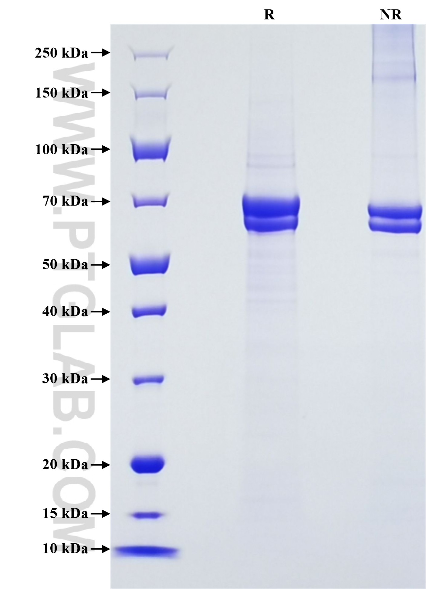 Purity of Recombinant Human TGFBI was determined by SDS-PAGE. The protein was resolved in an SDS-PAGE in reducing (R) and non-reducing (NR) conditions and stained using Coomassie blue.