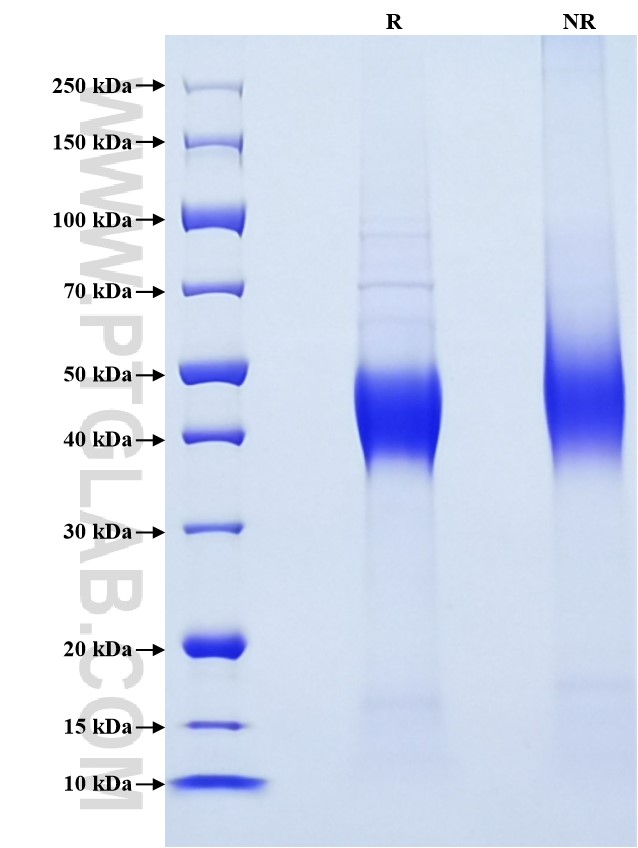 Purity of Recombinant Human IL-7RA was determined by SDS-PAGE. The protein was resolved in an SDS-PAGE in reducing (R) and non-reducing (NR) conditions and stained using Coomassie blue.