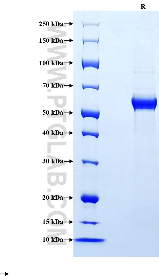 Purity of Recombinant Human IL-23 was determined by SDS-PAGE. The protein was resolved in an SDS-PAGE in reducing (R) conditions and stained using Coomassie blue. Purity of Recombinant Human IL-23 was determined by SDS-PAGE. The protein was resolved in an SDS-PAGE in reducing (R) conditions and stained using Coomassie blue.