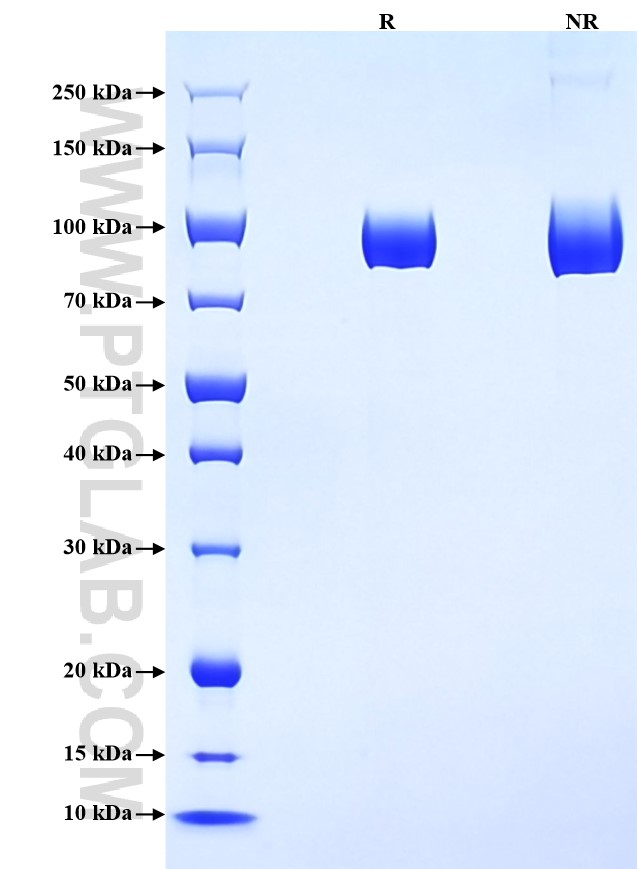 Purity of Recombinant Mouse DPP4 was determined by SDS-PAGE. The protein was resolved in an SDS-PAGE in reducing (R) and non-reducing (NR) conditions and stained using Coomassie blue. Purity of Recombinant Mouse DPP4 was determined by SDS-PAGE. The protein was resolved in an SDS-PAGE in reducing (R) and non-reducing (NR) conditions and stained using Coomassie blue.