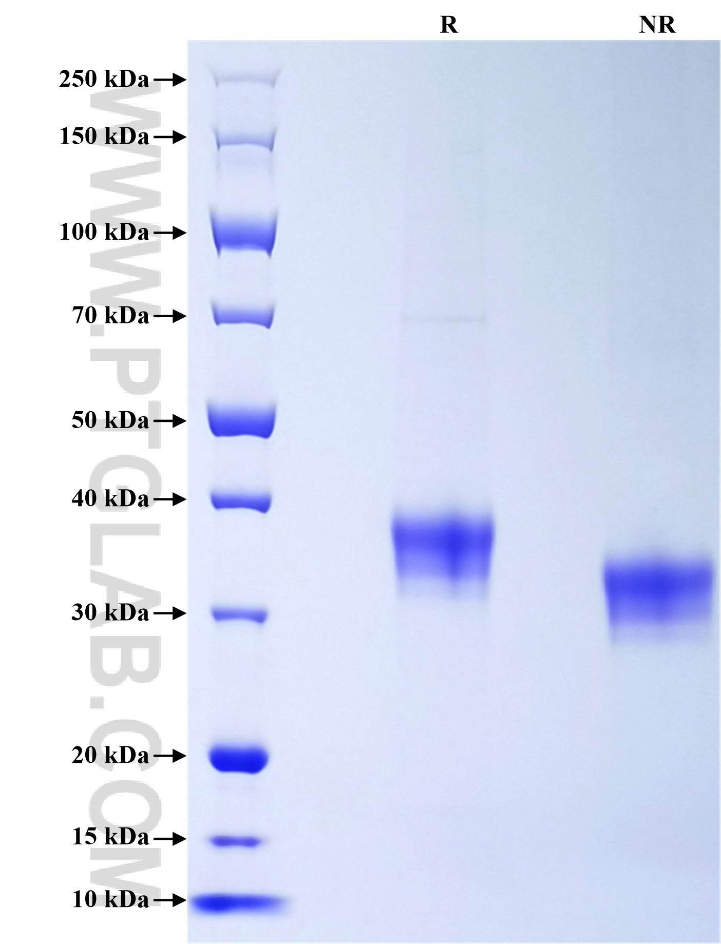Purity of Recombinant Mouse CD84 was determined by SDS-PAGE. The protein was resolved in an SDS-PAGE in reducing (R) and non-reducing (NR) conditions and stained using Coomassie blue. Purity of Recombinant Mouse CD84 was determined by SDS-PAGE. The protein was resolved in an SDS-PAGE in reducing (R) and non-reducing (NR) conditions and stained using Coomassie blue.