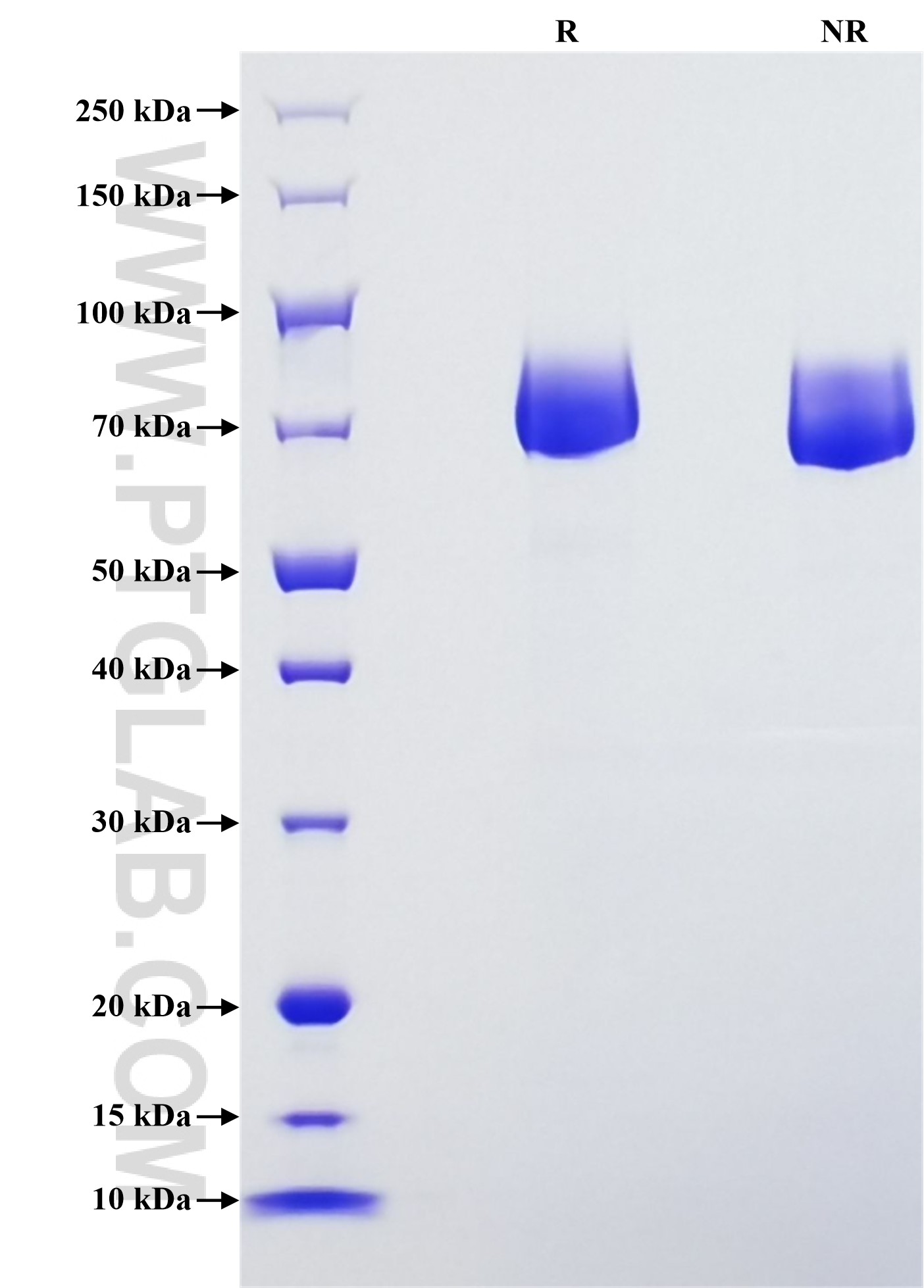 Purity of Recombinant Human Coagulation factor II was determined by SDS-PAGE. The protein was resolved in an SDS-PAGE in reducing (R) and non-reducing (NR) conditions and stained using Coomassie blue.