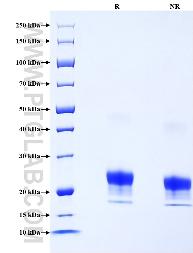 Purity of Recombinant Human CLEC4D was determined by SDS-PAGE. The protein was resolved in an SDS-PAGE in reducing (R) and non-reducing (NR) conditions and stained using Coomassie blue. Purity of Recombinant Human CLEC4D was determined by SDS-PAGE. The protein was resolved in an SDS-PAGE in reducing (R) and non-reducing (NR) conditions and stained using Coomassie blue.