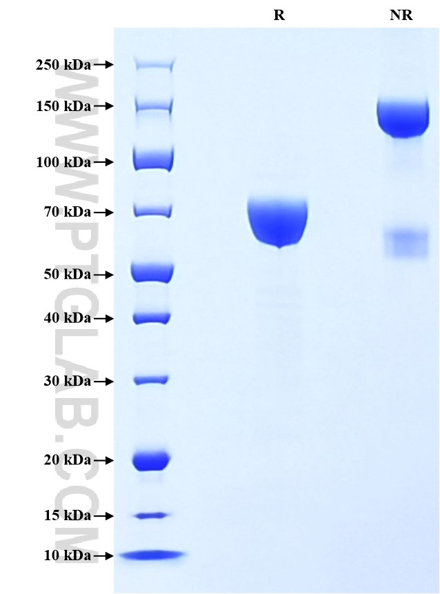 Purity of Recombinant Human IL-21R was determined by SDS-PAGE. The protein was resolved in an SDS-PAGE in reducing (R) and non-reducing (NR) conditions and stained using Coomassie blue.