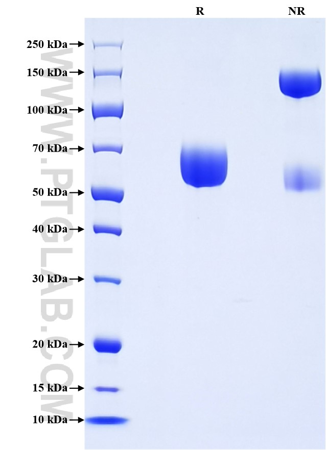 Purity of Recombinant Human NTB-A was determined by SDS-PAGE. The protein was resolved in an SDS-PAGE in reducing (R) and non-reducing (NR) conditions and stained using Coomassie blue. Purity of Recombinant Human NTB-A was determined by SDS-PAGE. The protein was resolved in an SDS-PAGE in reducing (R) and non-reducing (NR) conditions and stained using Coomassie blue.