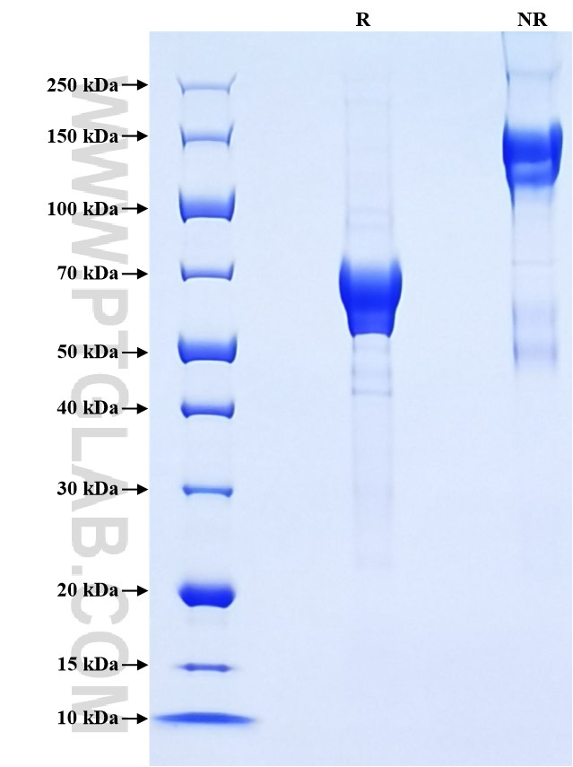 Purity of Recombinant Human NKp46 was determined by SDS-PAGE. The protein was resolved in an SDS-PAGE in reducing (R) and non-reducing (NR) conditions and stained using Coomassie blue.