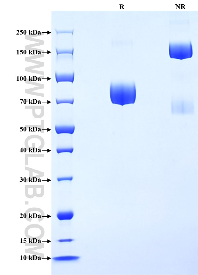 Purity of Recombinant Human Siglec-7 was determined by SDS-PAGE. The protein was resolved in an SDS-PAGE in reducing (R) and non-reducing (NR) conditions and stained using Coomassie blue. Purity of Recombinant Human Siglec-7 was determined by SDS-PAGE. The protein was resolved in an SDS-PAGE in reducing (R) and non-reducing (NR) conditions and stained using Coomassie blue.