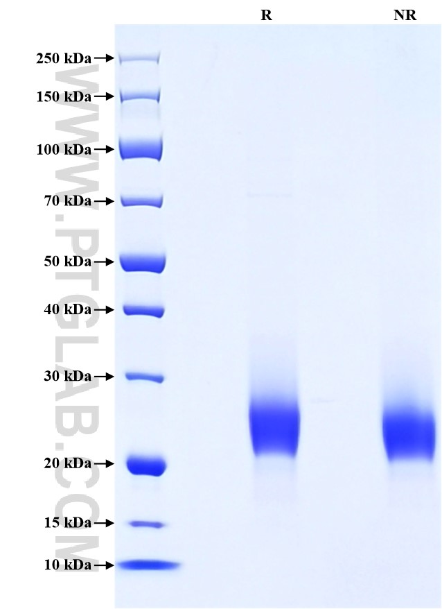 Purity of Recombinant Mouse CD90 was determined by SDS-PAGE. The protein was resolved in an SDS-PAGE in reducing (R) and non-reducing (NR) conditions and stained using Coomassie blue. Purity of Recombinant Mouse CD90 was determined by SDS-PAGE. The protein was resolved in an SDS-PAGE in reducing (R) and non-reducing (NR) conditions and stained using Coomassie blue.