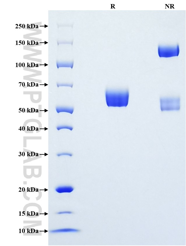 Purity of Recombinant Mouse CD84 was determined by SDS-PAGE. The protein was resolved in an SDS-PAGE in reducing (R) and non-reducing (NR) conditions and stained using Coomassie blue. Purity of Recombinant Mouse CD84 was determined by SDS-PAGE. The protein was resolved in an SDS-PAGE in reducing (R) and non-reducing (NR) conditions and stained using Coomassie blue.