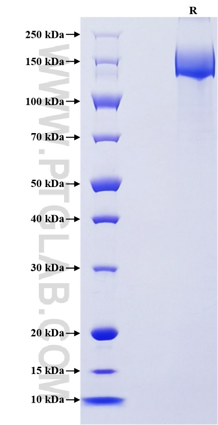 Purity of Recombinant Mouse CD21 was determined by SDS-PAGE. The protein was resolved in an SDS-PAGE in reducing (R) conditions and stained using Coomassie blue.