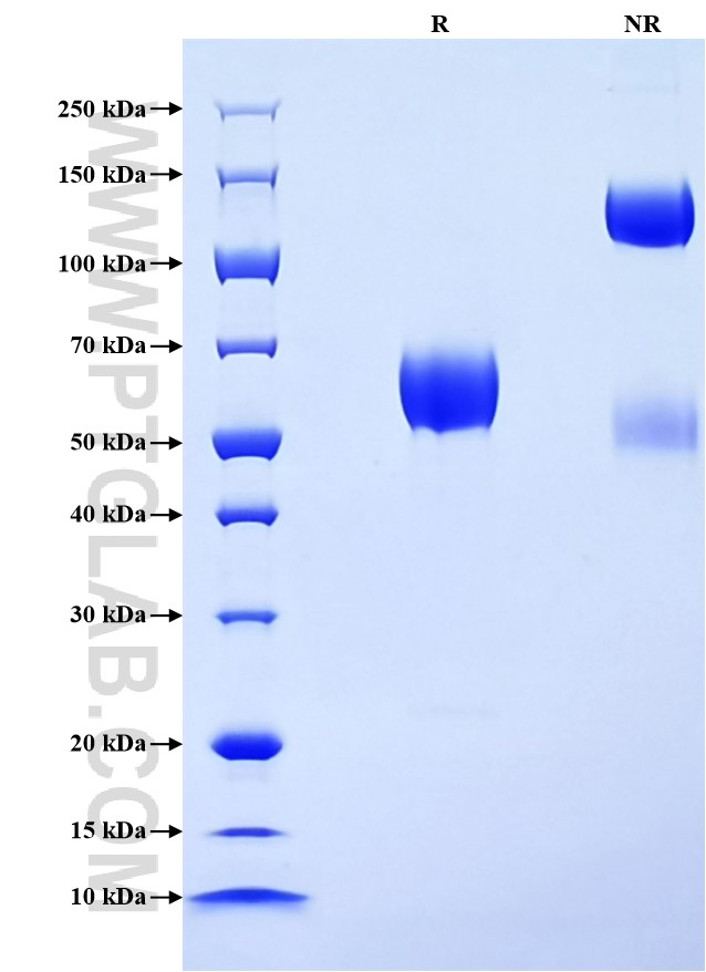 Purity of Recombinant Mouse CD2 was determined by SDS-PAGE. The protein was resolved in an SDS-PAGE in reducing (R) and non-reducing (NR) conditions and stained using Coomassie blue.