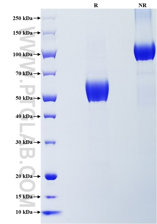 Purity of Recombinant Mouse CD28 was determined by SDS-PAGE. The protein was resolved in an SDS-PAGE in reducing (R) and non-reducing (NR) conditions and stained using Coomassie blue. Purity of Recombinant Mouse CD28 was determined by SDS-PAGE. The protein was resolved in an SDS-PAGE in reducing (R) and non-reducing (NR) conditions and stained using Coomassie blue.