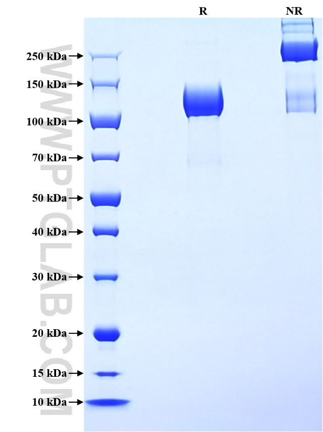 Purity of Recombinant Mouse Semaphorin 4D was determined by SDS-PAGE. The protein was resolved in an SDS-PAGE in reducing (R) and non-reducing (NR) conditions and stained using Coomassie blue. Purity of Recombinant Mouse Semaphorin 4D was determined by SDS-PAGE. The protein was resolved in an SDS-PAGE in reducing (R) and non-reducing (NR) conditions and stained using Coomassie blue.