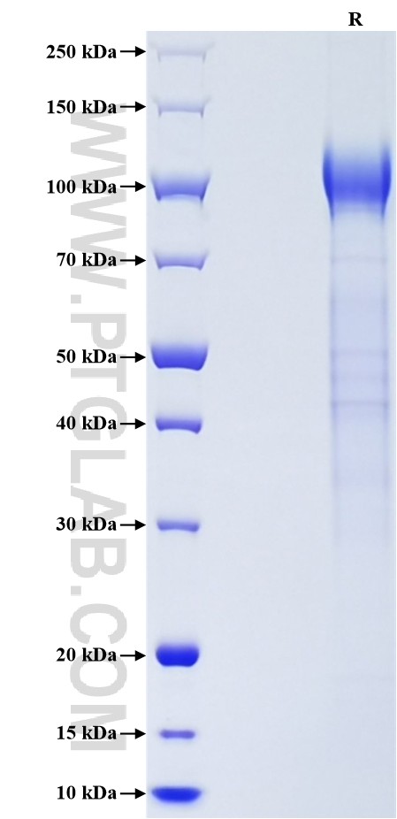 Purity of Recombinant Human KIM-1 was determined by SDS-PAGE. The protein was resolved in an SDS-PAGE in reducing (R) conditions and stained using Coomassie blue. Purity of Recombinant Human KIM-1 was determined by SDS-PAGE. The protein was resolved in an SDS-PAGE in reducing (R) conditions and stained using Coomassie blue.