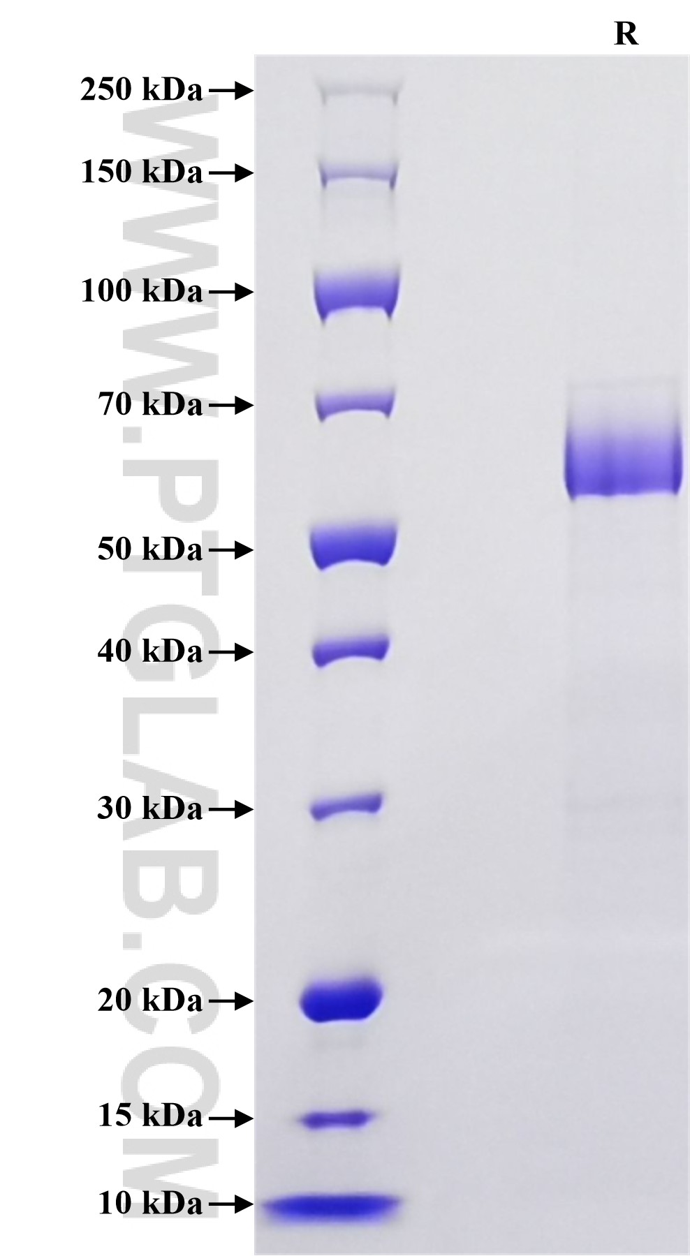 Purity of Recombinant Rat CD25 was determined by SDS-PAGE. The protein was resolved in an SDS-PAGE in reducing (R) conditions and stained using Coomassie blue. Purity of Recombinant Rat CD25 was determined by SDS-PAGE. The protein was resolved in an SDS-PAGE in reducing (R) conditions and stained using Coomassie blue.