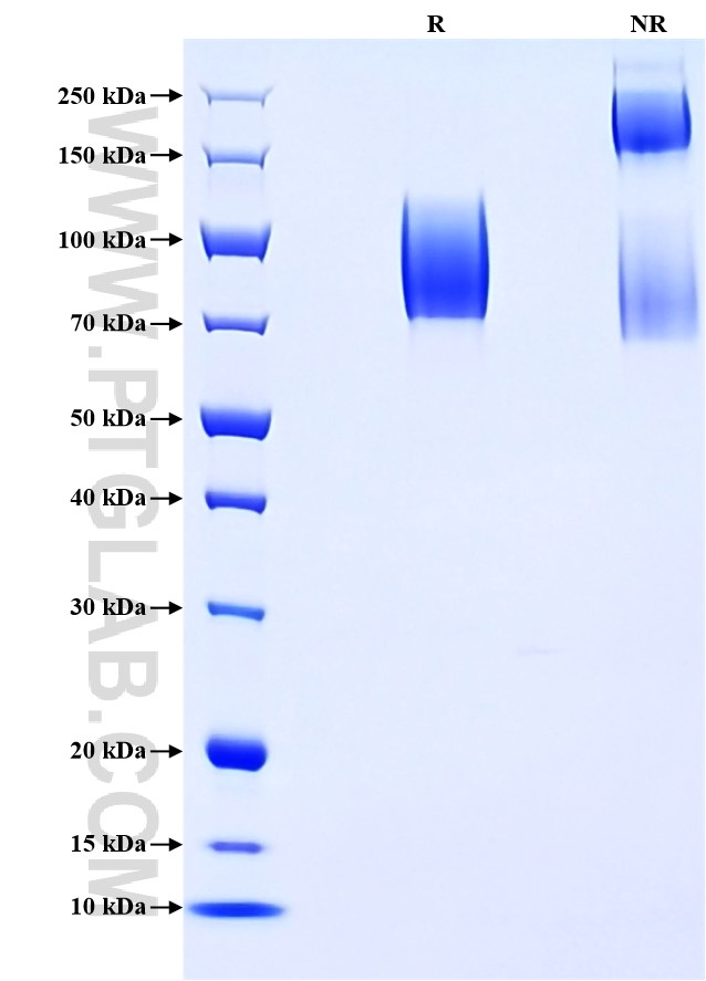 Purity of Recombinant Rat CD68 was determined by SDS-PAGE. The protein was resolved in an SDS-PAGE in reducing (R) and non-reducing (NR) conditions and stained using Coomassie blue. Purity of Recombinant Rat CD68 was determined by SDS-PAGE. The protein was resolved in an SDS-PAGE in reducing (R) and non-reducing (NR) conditions and stained using Coomassie blue.