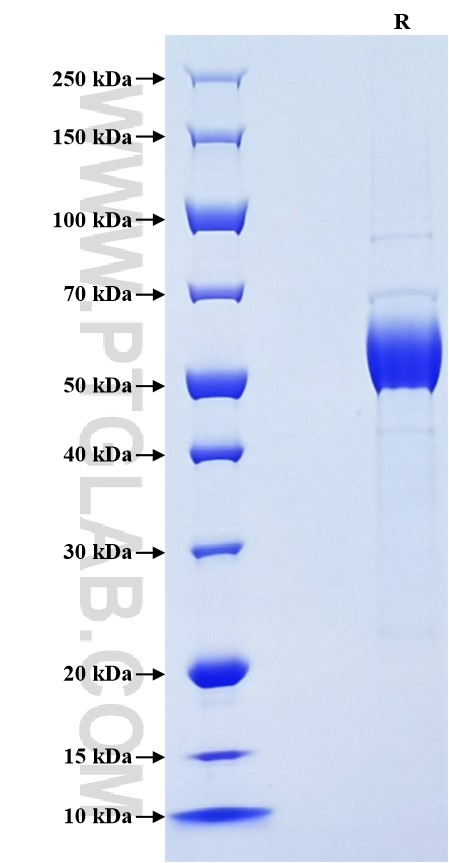 Purity of Recombinant Rat KLRB1A was determined by SDS-PAGE. The protein was resolved in an SDS-PAGE in reducing (R) conditions and stained using Coomassie blue.