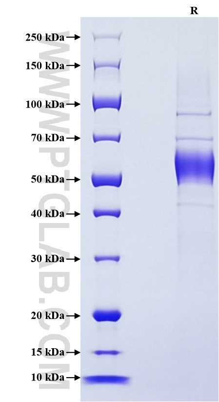 Purity of Recombinant Mouse NKG2C was determined by SDS-PAGE. The protein was resolved in an SDS-PAGE in reducing (R) conditions and stained using Coomassie blue. Purity of Recombinant Mouse NKG2C was determined by SDS-PAGE. The protein was resolved in an SDS-PAGE in reducing (R) conditions and stained using Coomassie blue.