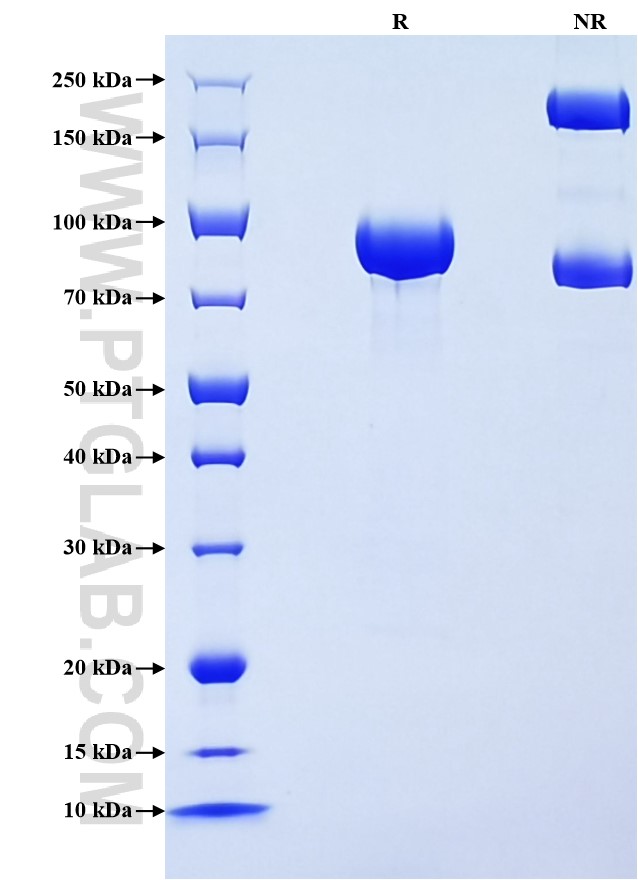 Purity of Recombinant Human Alpha 1B-Glycoprotein
 was determined by SDS-PAGE. The protein was resolved in an SDS-PAGE in reducing (R) and non-reducing (NR) conditions and stained using Coomassie blue.