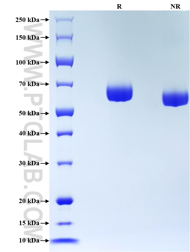 Purity of Recombinant Human Alpha 1B-Glycoprotein was determined by SDS-PAGE. The protein was resolved in an SDS-PAGE in reducing (R) and non-reducing (NR) conditions and stained using Coomassie blue.