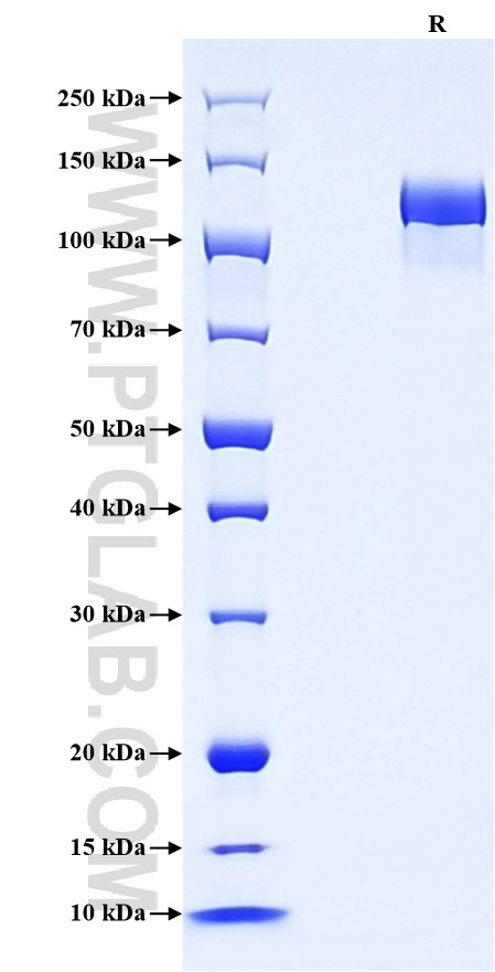 Purity of Recombinant Mouse Tie-2 was determined by SDS-PAGE. The protein was resolved in an SDS-PAGE in reducing (R) conditions and stained using Coomassie blue.