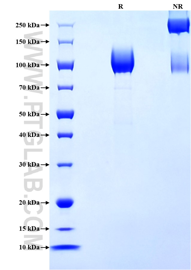 Purity of Recombinant Mouse PDGFR beta was determined by SDS-PAGE. The protein was resolved in an SDS-PAGE in reducing (R) and non-reducing (NR) conditions and stained using Coomassie blue.