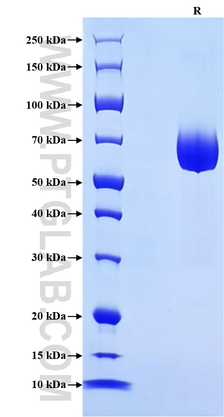 Purity of Recombinant Mouse CD226 was determined by SDS-PAGE. The protein was resolved in an SDS-PAGE in reducing (R) conditions and stained using Coomassie blue. Purity of Recombinant Mouse CD226 was determined by SDS-PAGE. The protein was resolved in an SDS-PAGE in reducing (R) conditions and stained using Coomassie blue.