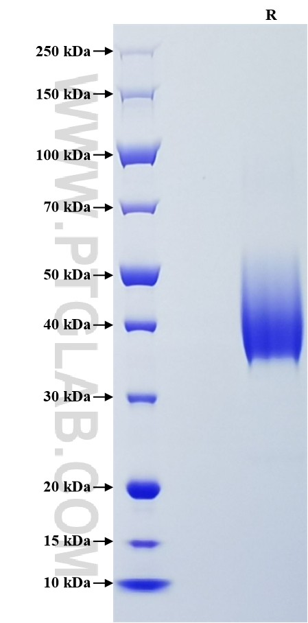 Purity of Recombinant Human GPR132 was determined by SDS-PAGE. The protein was resolved in an SDS-PAGE in reducing (R) conditions and stained using Coomassie blue. Purity of Recombinant Human GPR132 was determined by SDS-PAGE. The protein was resolved in an SDS-PAGE in reducing (R) conditions and stained using Coomassie blue.