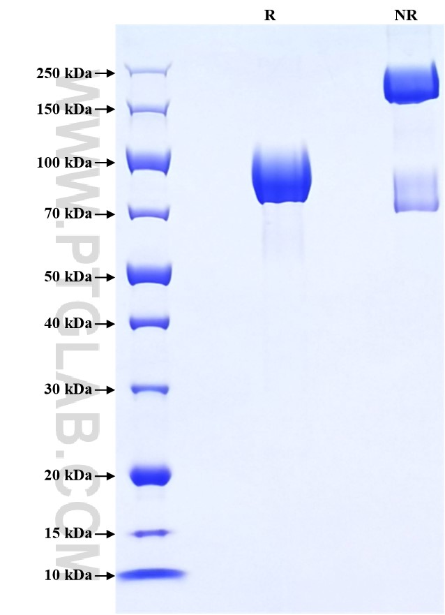 Purity of Recombinant Human AXL was determined by SDS-PAGE. The protein was resolved in an SDS-PAGE in reducing (R) and non-reducing (NR) conditions and stained using Coomassie blue.