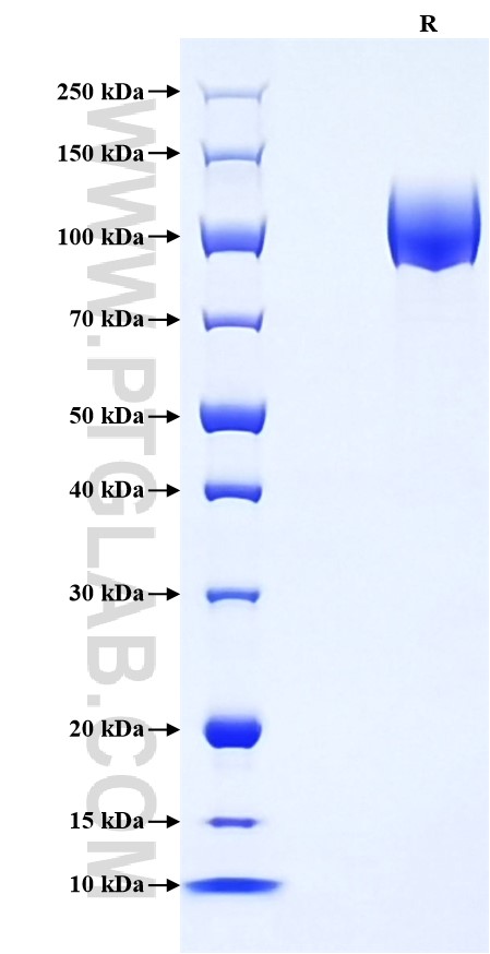 Purity of Recombinant Mouse PDGF R alpha was determined by SDS-PAGE. The protein was resolved in an SDS-PAGE in reducing (R) condition and stained using Coomassie blue. Purity of Recombinant Mouse PDGF R alpha was determined by SDS-PAGE. The protein was resolved in an SDS-PAGE in reducing (R) condition and stained using Coomassie blue.