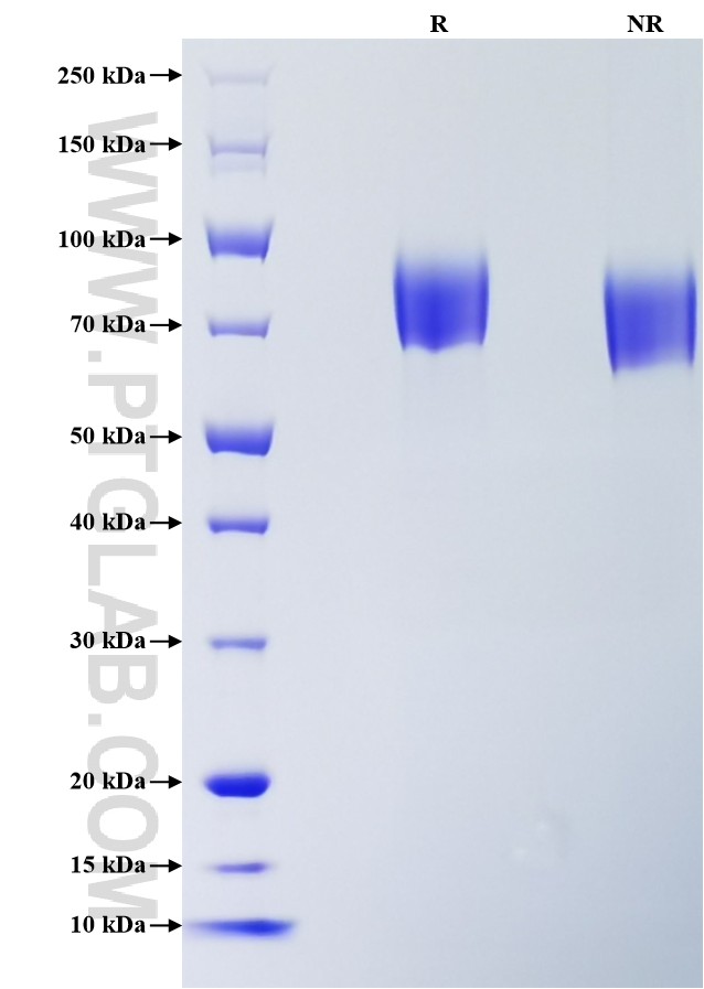Purity of Recombinant Mouse PDGF R alpha was determined by SDS-PAGE. The protein was resolved in an SDS-PAGE in reducing (R) and non-reducing (NR) conditions and stained using Coomassie blue. Purity of Recombinant Mouse PDGF R alpha was determined by SDS-PAGE. The protein was resolved in an SDS-PAGE in reducing (R) and non-reducing (NR) conditions and stained using Coomassie blue.