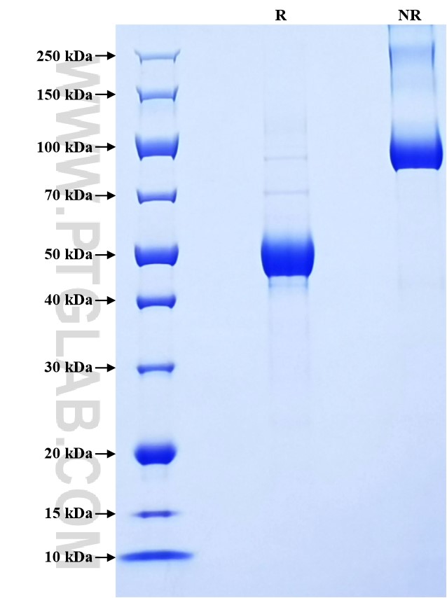 Purity of Recombinant Mouse IL-23 p19 was determined by SDS-PAGE. The protein was resolved in an SDS-PAGE in reducing (R) and non-reducing (NR) conditions and stained using Coomassie blue.