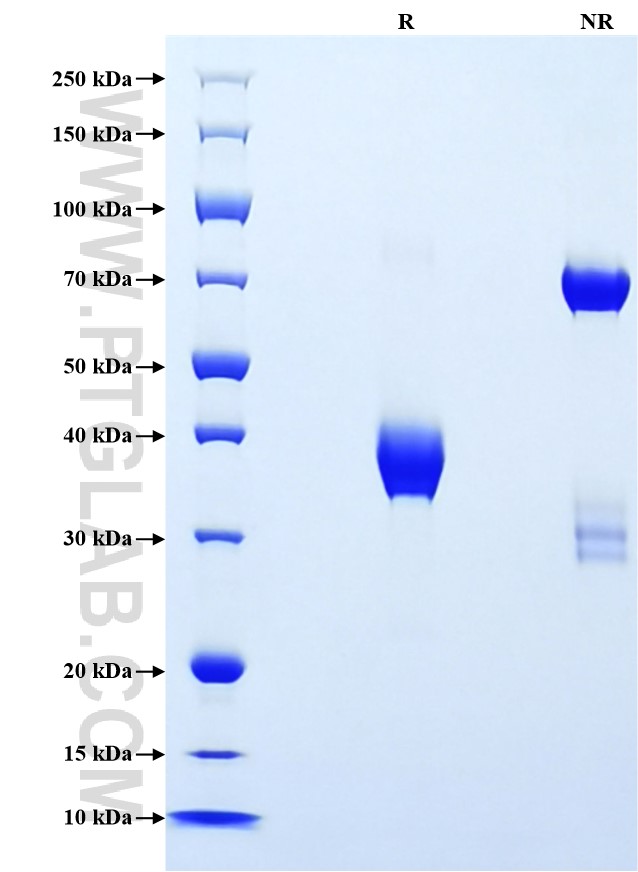 Purity of Recombinant Mouse CXCL5 was determined by SDS-PAGE. The protein was resolved in an SDS-PAGE in reducing (R) and non-reducing (NR) conditions and stained using Coomassie blue.