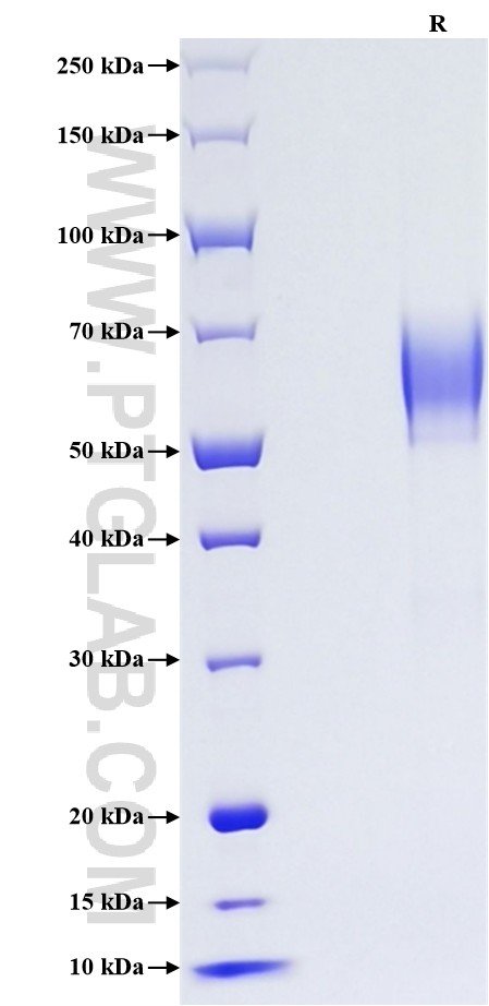 Purity of Recombinant Human CD27 was determined by SDS-PAGE. The protein was resolved in an SDS-PAGE in reducing (R) conditions and stained using Coomassie blue. Purity of Recombinant Human CD27 was determined by SDS-PAGE. The protein was resolved in an SDS-PAGE in reducing (R) conditions and stained using Coomassie blue.