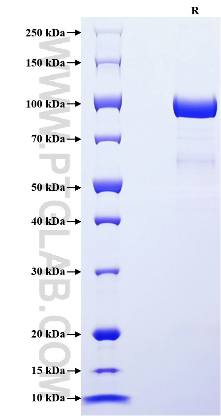 Purity of Recombinant Human MMP-2 was determined by SDS-PAGE. The protein was resolved in an SDS-PAGE in reducing (R) conditions and stained using Coomassie blue. Purity of Recombinant Human MMP-2 was determined by SDS-PAGE. The protein was resolved in an SDS-PAGE in reducing (R) conditions and stained using Coomassie blue.