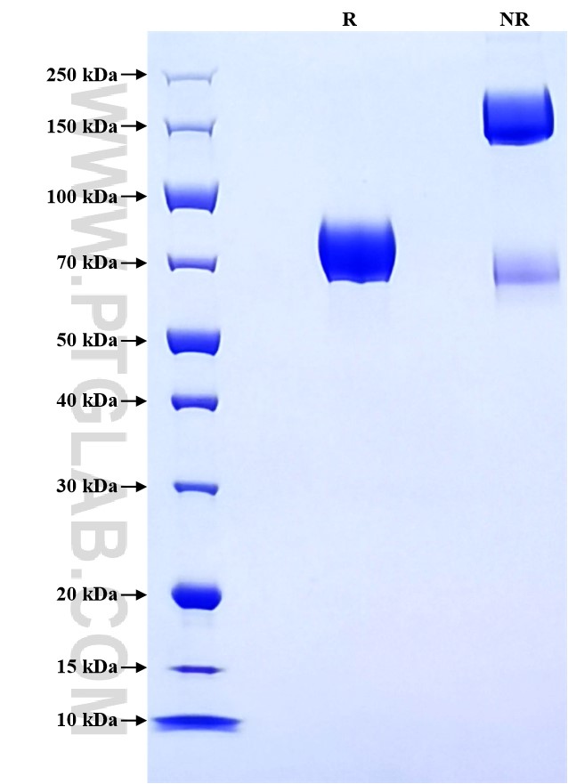 Purity of Recombinant Human SIRP beta 1 was determined by SDS-PAGE. The protein was resolved in an SDS-PAGE in reducing (R) and non-reducing (NR) conditions and stained using Coomassie blue.