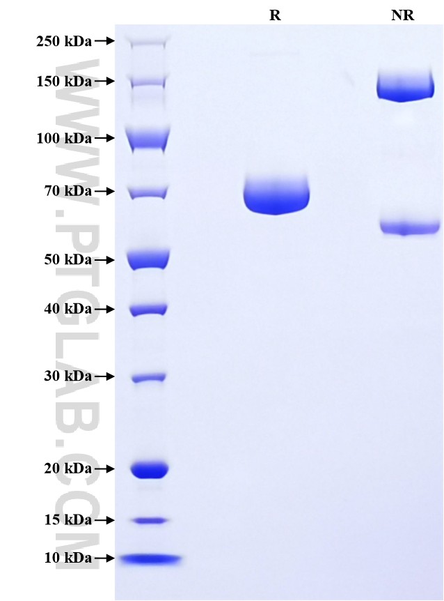 Purity of Recombinant Human Nectin-2 was determined by SDS-PAGE. The protein was resolved in an SDS-PAGE in reducing (R) and non-reducing (NR) conditions and stained using Coomassie blue. Purity of Recombinant Human Nectin-2 was determined by SDS-PAGE. The protein was resolved in an SDS-PAGE in reducing (R) and non-reducing (NR) conditions and stained using Coomassie blue.