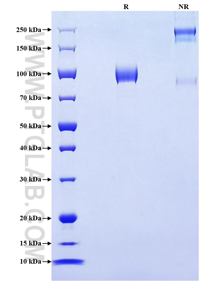 Purity of Recombinant Human Siglec-5 was determined by SDS-PAGE. The protein was resolved in an SDS-PAGE in reducing (R) and non-reducing (NR) conditions and stained using Coomassie blue. Purity of Recombinant Human Siglec-5 was determined by SDS-PAGE. The protein was resolved in an SDS-PAGE in reducing (R) and non-reducing (NR) conditions and stained using Coomassie blue.