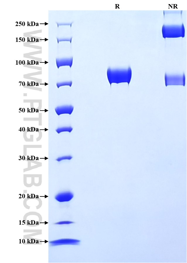 Purity of Recombinant Human DDR1 was determined by SDS-PAGE. The protein was resolved in an SDS-PAGE in reducing (R) and non-reducing (NR) conditions and stained using Coomassie blue.