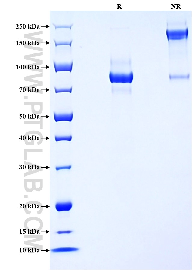 Purity of Recombinant Human SELPLG was determined by SDS-PAGE. The protein was resolved in an SDS-PAGE in reducing (R) and non-reducing (NR) conditions and stained using Coomassie blue. Purity of Recombinant Human SELPLG was determined by SDS-PAGE. The protein was resolved in an SDS-PAGE in reducing (R) and non-reducing (NR) conditions and stained using Coomassie blue.
