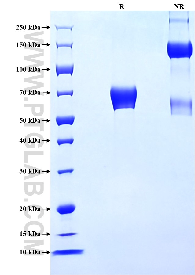 Purity of Recombinant Human KIR2DL2 was determined by SDS-PAGE. The protein was resolved in an SDS-PAGE in reducing (R) and non-reducing (NR) conditions and stained using Coomassie blue.