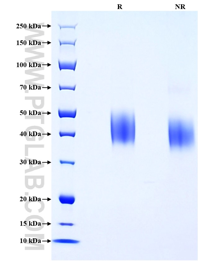 Purity of Recombinant Human SLAM was determined by SDS-PAGE. The protein was resolved in an SDS-PAGE in reducing (R) and non-reducing (NR) conditions and stained using Coomassie blue.