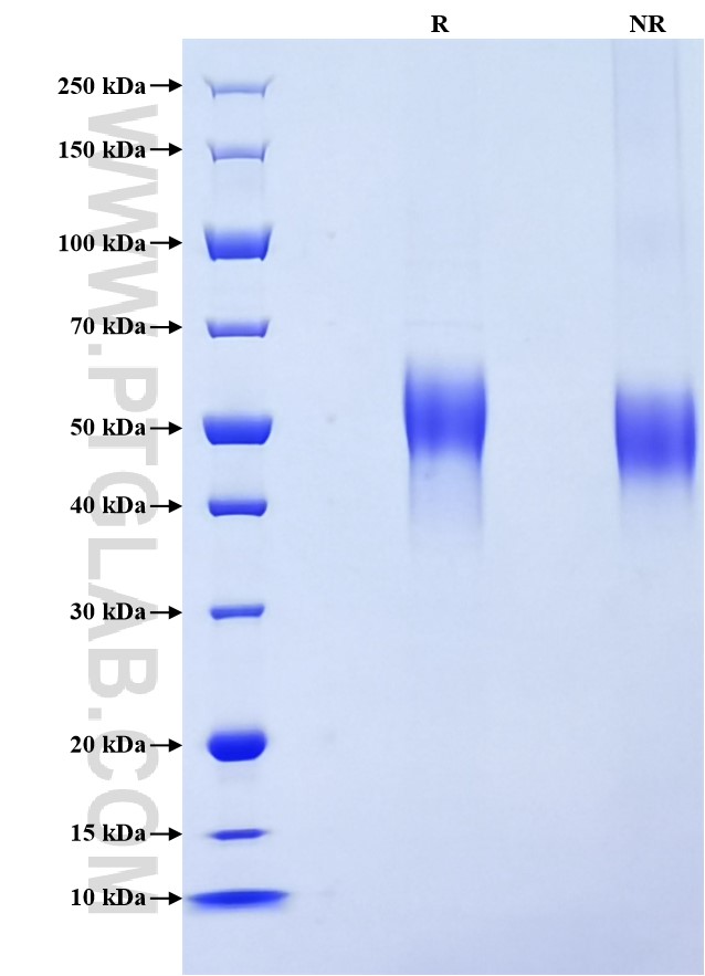 Purity of Recombinant Human IL-2RG was determined by SDS-PAGE. The protein was resolved in an SDS-PAGE in reducing (R) and non-reducing (NR) conditions and stained using Coomassie blue.